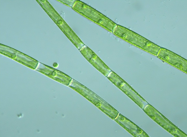 Reticulate in Oedogonium.